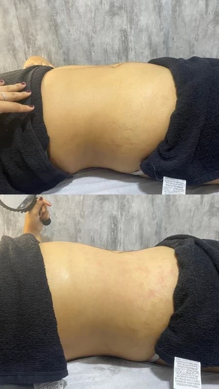 Antes e depois de caso real de StrilRepair — resultado 1