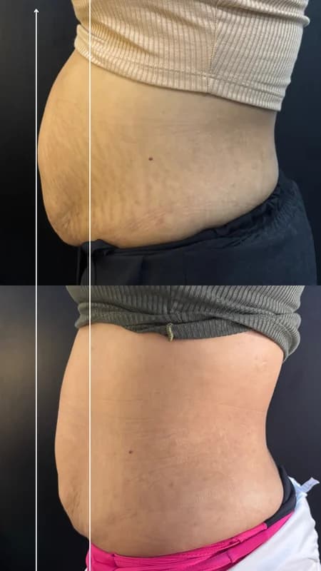 Antes e depois de caso real de StrilRepair — resultado 2