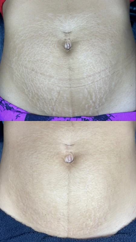 Antes e depois de caso real de StrilRepair — resultado 3