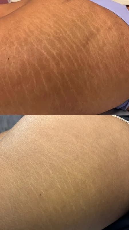 Antes e depois de caso real de StrilRepair — resultado 5